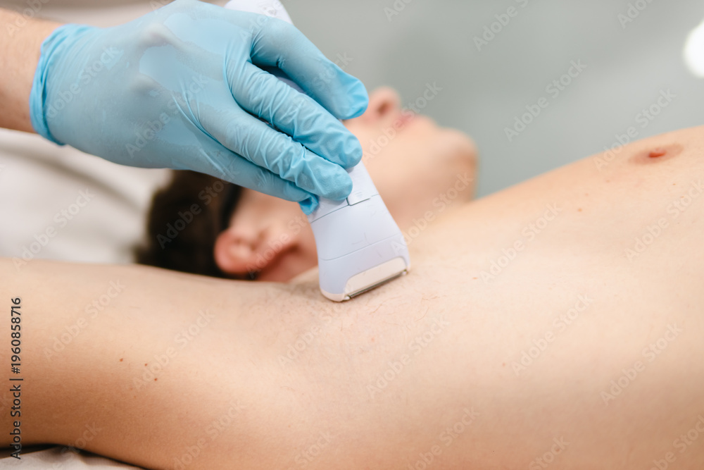 Fototapeta premium Man receiving effective laser hair removal treatment from a professional technician wearing blue gloves, targeting unwanted underarm hair for smooth skin