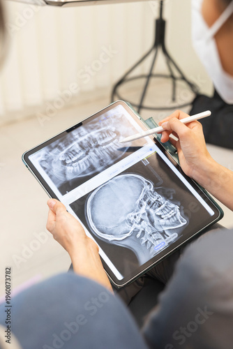 Dentist examining dental x-ray on digital tablet