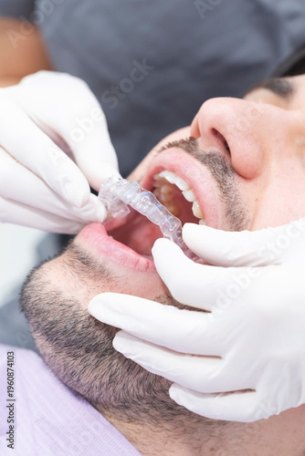 Dentist putting invisible dental aligner on male patient