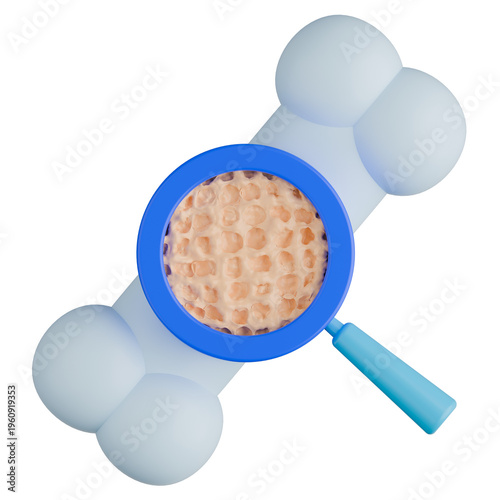 3D Osteoporosis Bone with Magnifying Glass Illustration.
