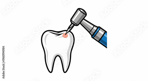 Dental drill working on a tooth