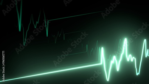 ECG chart line shows heart rhythm - heart attack, signs of life, medical monitoring, clinic, emergency, heart rate, cardiology, healthcare, emergency care, first aid, dying, health, green
