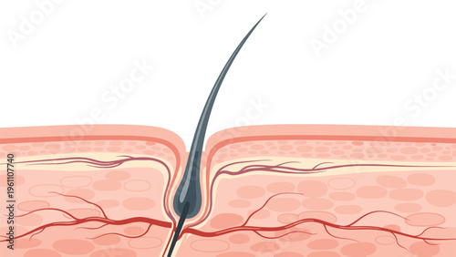 Detailed medical illustration showing a single hair follicle root embedded within the layers of human skin and surrounding blood vessels.