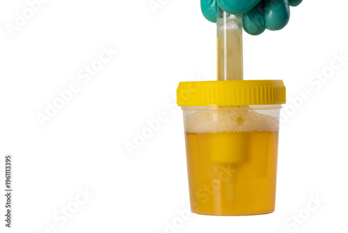 Transferring urine into a transport tube with reagents for bacterial culture testing, white background. Diagnosis of bacterial infections and microorganisms with antibiotic sensitivity. Copy space for