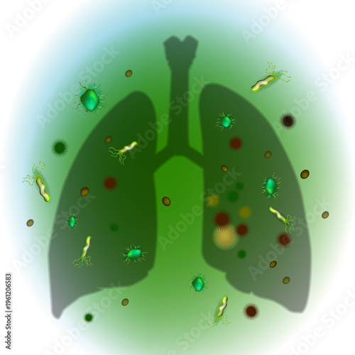 Conceptual medical illustration of lungs surrounded by bacteria, viruses, and microorganisms, representing respiratory infections and pulmonary diseases. Impact of microbes on the respiratory system. 