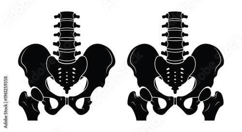 Anatomical illustration of human pelvic bones in black silhouette