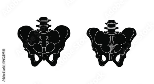 Anatomical illustration of human pelvic bones in a dark silhouette