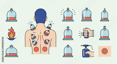 Cupping Therapy Set: Back Treatment, Fire, Pump, Hand on Light Green Background
