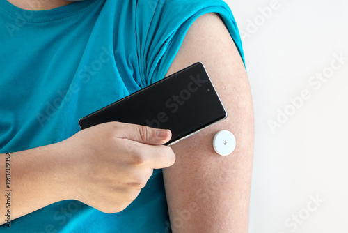 Obraz na plátne overweight man checks his blood sugar level using a smartphone and a continuous glucose monitoring system