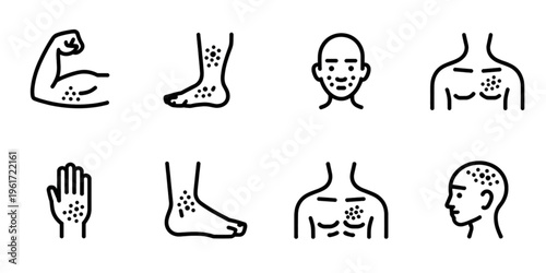 A collection of line art icons representing various skin conditions and rashes on human body parts Vector