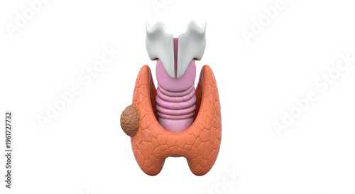 Thyroid Gland Anatomy with Tumor