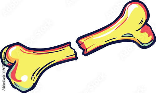 Vsai broken human bone showing injury and pain