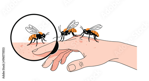 Educational illustration showing mosquitoes biting a human hand with a magnified view of the insect feeding on skin.