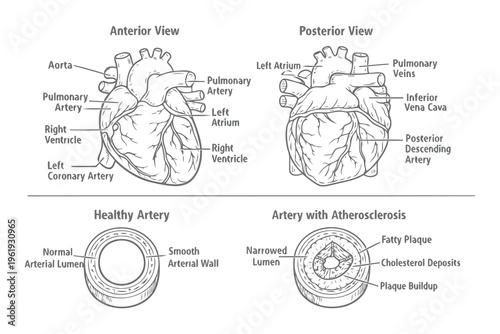 Anatomical illustration of the human heart and a comparison between healthy and diseased arteries Vector