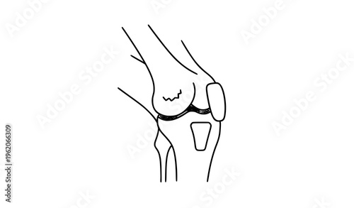 Knee arthritis line icon joint pain medical vector illustration