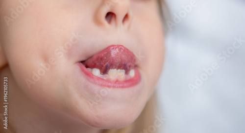 Child showing tongue, Young girl sticking out tongue, playful expression, tongue visible, speech therapy, pronunciation practice session, practicing sounds, oral anatomy health, dental tongue exercise