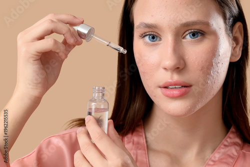 Young woman with acne probl...