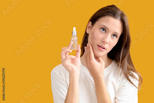 Young woman with acne probl...