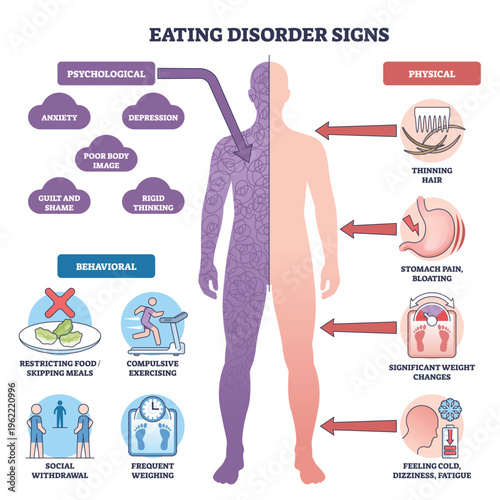 Eating disorder signs brief outline depicts a split human figure with labels and arrows highlighting psychological, behavioral, and physical symptoms. Outline diagram