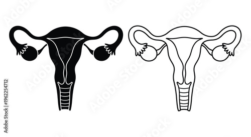 Female reproductive system illustration uterus and ovaries in two variations