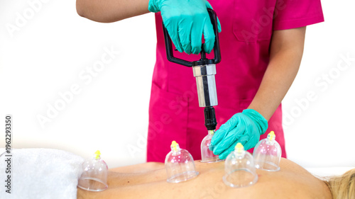 Cupping therapy on woman back in spa clinic, therapist using vacuum device and cups for alternative medicine, pain relief and wellness treatment