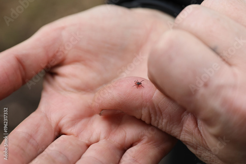 Εκτύπωση καμβά taiga encephalitis tick on a human arm