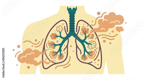Illustration of human lungs affected by pollution, smoke, or respiratory disease
