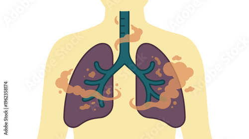 Human lungs affected by air pollution or smoking, medical illustration