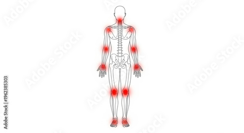 A vector graphic illustration of a human skeleton with red highlighted pain areas on joints and muscles