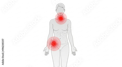 A vector graphic illustration of a woman with highlighted pain areas on her body