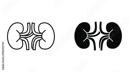 Comparison of healthy and affected kidneys with internal structures highlighted