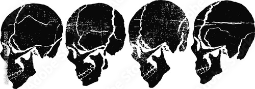 Human skull lateral views anatomical bone structure illustration showing side profile of cranium in four positions