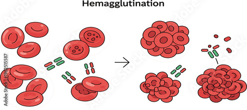 Hemagglutination Process Illustration with Red Blood Cells Clumping, Antigen Antibody Reaction, Immunology Concept and Medical Laboratory Test Diagram