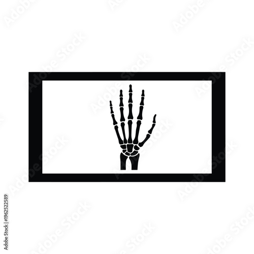 Hand X-ray with visible finger bones silhouette