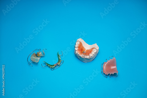 The Retainer Showcase: Orthodontic Appliances on a Bright Blue Blueprint