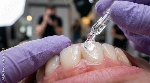Applying liquid bonding agent to front tooth during dental procedure.