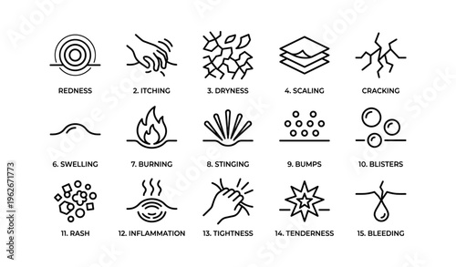 15 skin conditions: redness, itching, dryness, scaling, cracking, swelling, burning, stinging