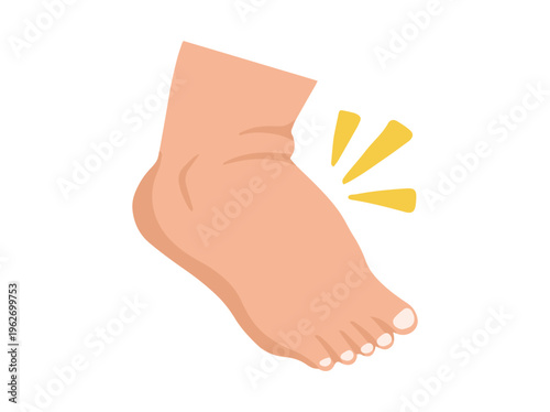 Hand Drawn Edema Foot Disease Illustration
