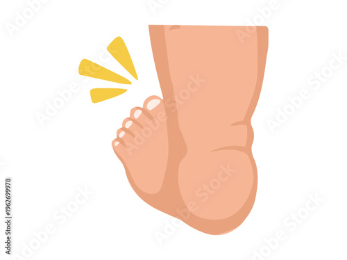 Edema Foot Healthcare Illustration
