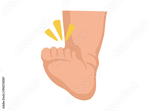 Hand Drawn Edema Foot Disease Illustration
