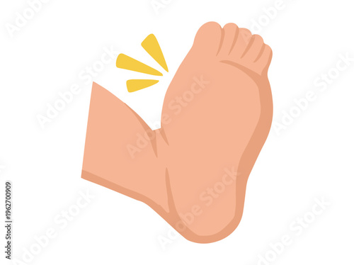 Hand Drawn Edema Foot Disease Illustration
