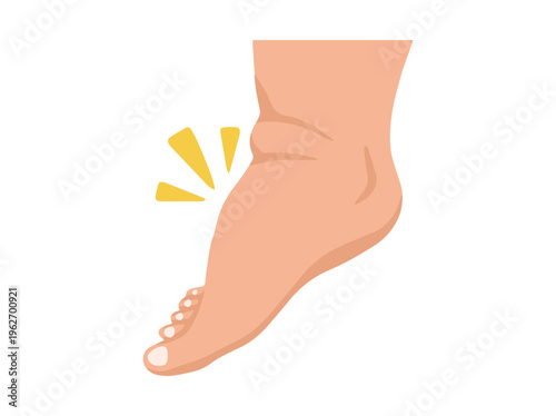 Edema Foot Healthcare Illustration
