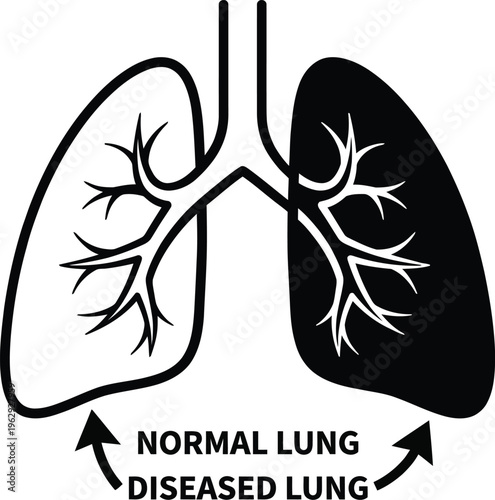 Comparison of a healthy lung and a diseased lung