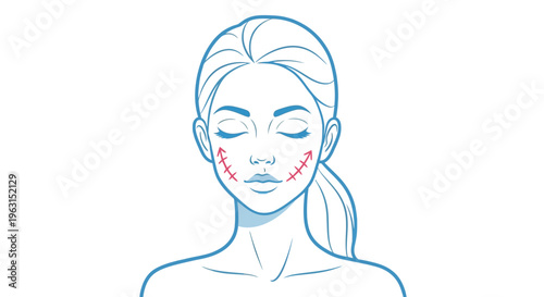 Vector illustration of a woman's face with red marked areas for cosmetic surgery