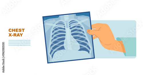Doctor Holding Chest X-Ray with Lungs – Medical Illustration Concept for Healthcare Landing Page, Medical X-Ray Set