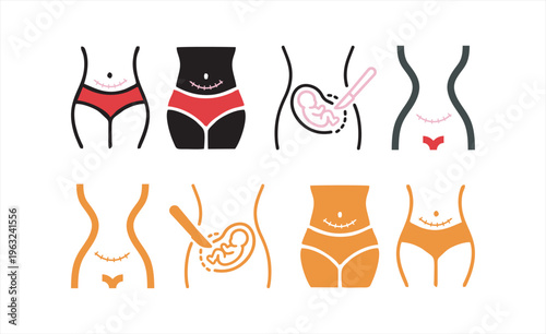 Printcesarean section icon with scar, line and solid design, Woman cares for her body after childbirth by applying medical ointment to surgical incision. Postpartum recovery process and skin care for 