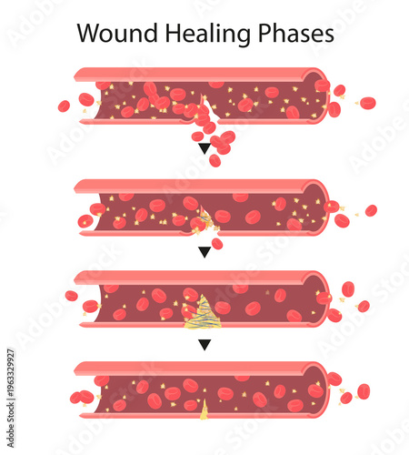 Wound Healing Phases