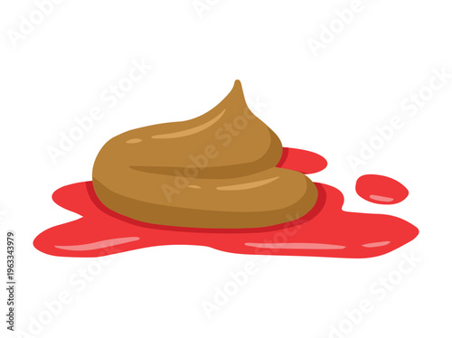 Feces Diarrhea Blood Ebola Illustration
