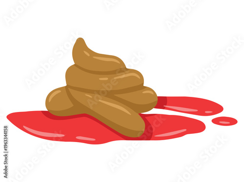 Stool Diarrhea Blood Ebola Illustration
