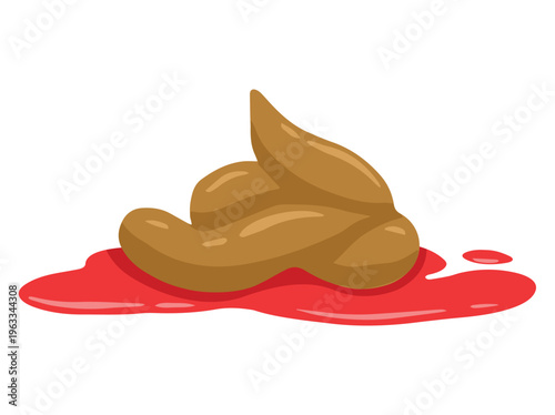 Poop Diarrhea Blood Ebola Illustration